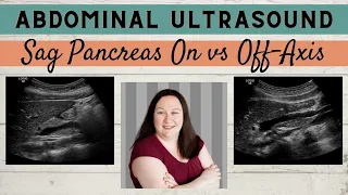 General Ultrasound | Sag Pancreas | On vs Off Axis