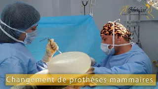 Changement de prothèses mammaires