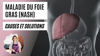 NASH : stéatose hépatique (foie gras) / causes et solutions