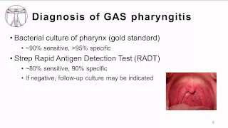 GAS pharyngitis: Diagnosis and Treatment