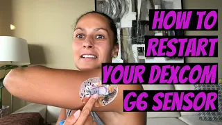 How to Restart Your Dexcom G6 Sensor