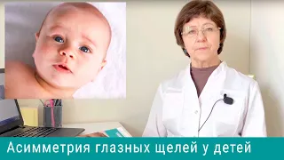 Узкая глазная щель у детей, асимметрия глазных щелей - симптом родовой травмы