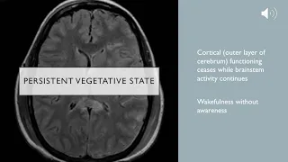 Clinical Death, Whole Brain Death, and Persistent Vegetative State