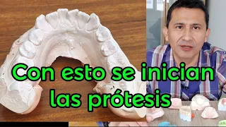 Modelos dentales. Qué es y Para qué sirve?