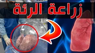 كيف يزرعون الرئة ؟ | أفضل دكتور لزراعة الرئة في الهند