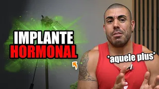 Tudo sobre implante hormonal