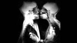 The anatomy of kissing and love in magnetic resonance imaging (MRI) scanner