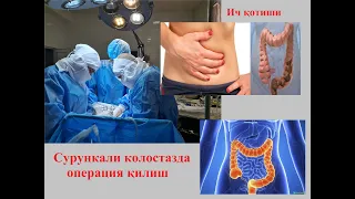 Сурункали колостазда операция. Ич қотиши: сабаблари, клиникаси, даволаш.