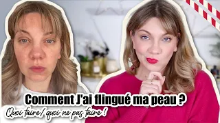 SOS, J'AI FLINGUÉ MA PEAU ! Quoi faire et quoi ne pas faire!?