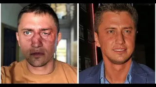 Конфликт в ночном клубе: кто избил Павла Прилучного?