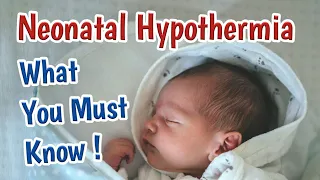 Newborn Hypothermia In Premature & Term Babies | Newborn Cold Stress