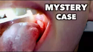 MYSTERY CASE (do you know what this is?) | Dr. Paul