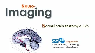 Brain imaging (anatomy & cerebrovascular stroke) Prof. Mamdouh Mahfouz