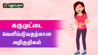 கருமுட்டை வெளிப்படுவதற்கான அறிகுறிகள்..! (Ovulation Symptoms) | Dr.M.S.UshaNandhini | PuthuyugamTV