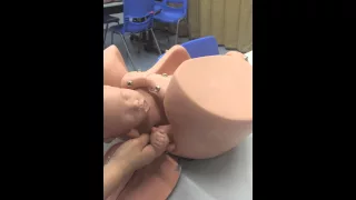 Shoulder dystocia - removing posterior arm