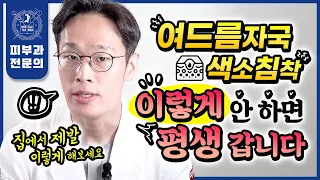 절대 안 없어지는 여드름자국 색소침착 완치하는 법 | 자가치료부터 전후 변화까지 이 영상 하나로 완벽하게 종결!