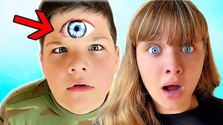 My LITTLE BROTHER Grew an EXTRA EYE!