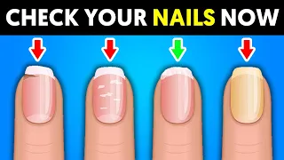 Warning: 8 Things Your Nails Tell You About Your Health