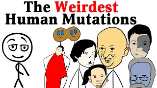 Strangest Human Mutations and Medical Conditions