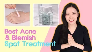 BEST! (must watch!) Acne Treatment Solutions for Ance Prone Skin