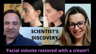 Facial fat volume loss and how to restore it naturally | Adipeau founder on breakthrough treatment