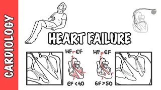 Heart failure with reduced and preserved ejection fraction, pathophysiology and treatment