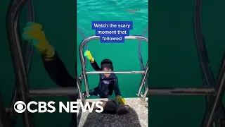 A shark bit an 8-year-old boy during a fishing trip in Australia, leaving a minor bite mark #shorts