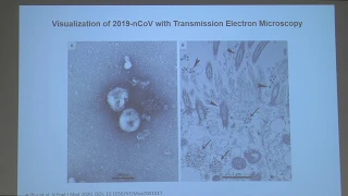 The Wuhan Corona Virus: Have the lessons learned from SARS helped? - Jan. 30, 2020