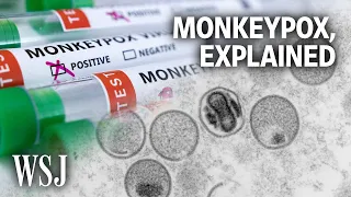 What to Know About the Monkeypox Outbreak | WSJ