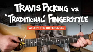 Travis Picking vs. "Normal" Fingerstyle