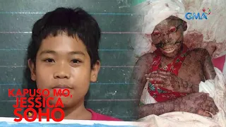 BALAT NG 14-ANYOS, PIRMING NAGBABALAT, NAGSUSUGAT AT NAGDURUGO | Kapuso Mo, Jessica Soho