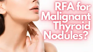 Radiofrequency Ablation (RFA) be Used for Treating Malignant Thyroid Nodules — Dr. Leonardo Rangel