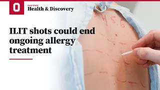 ILIT shots could end ongoing allergy treatment | Ohio State Medical Center