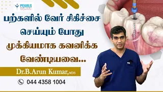 பற்களில் வேர் சிகிச்சை செய்யும் போது முக்கியமாக கவனிக்க வேண்டியவை.!- Pearls Dentistry-Dr. Arun Kumar