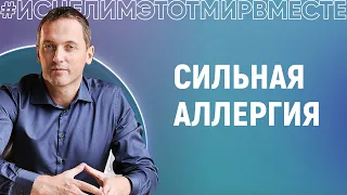 Сильная аллергия - Онлайн консультация Артема Толоконина