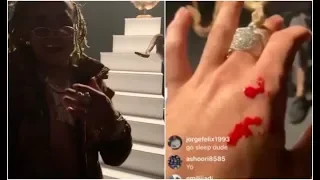 Venomous Snake Bites Lil Pump At At El Alfa El Jefe Coranado Video Shoot