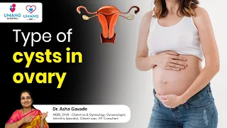 Types Of Cysts in Ovary | Dr. Asha Gavade | Umang Hospital