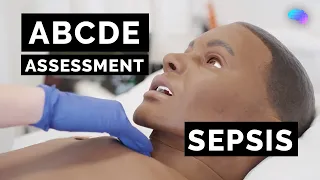 ABCDE Assessment | Sepsis | Emergency Simulation Scenario | OSCE Guide