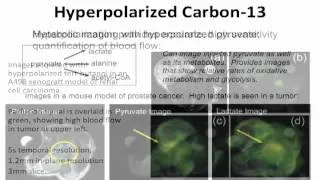 Hyperpolarized Carbon 13 MRI for Imaging of Metabolism and Perfusion - Aaron Grant