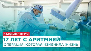 Аритмия сердца. Желудочковая экстрасистолия. Оперативное лечение. Отзыв пациента