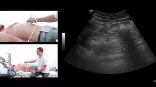 How to perform an ultrasound exam of the pancreas