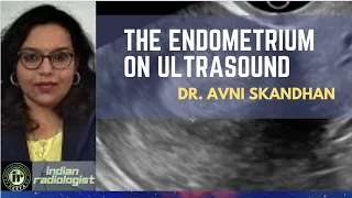 The Endometrium on Ultrasound || Dr Avni Skandhan || Beginner Tips || Endometrial changes
