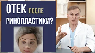 ОТЕК ПОСЛЕ РИНОПЛАСТИКИ 🤭😱 ПРОБЛЕМА❓