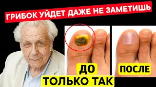 Неумывакин: Все грибки уйдут! От грибка ногтей и кожи!