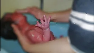 Newborn baby first shower after delivery | newborn hygienec | History Creater Medics