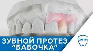 Зубной протез "Бабочка" - когда они показаны. Протезирование зубов
