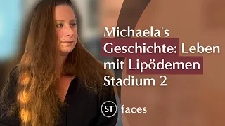 Michaela's Geschichte: Leben mit Lipödemen Stadium 2 | Fettabsaugung | faces ❤️ ich stehe zu mir!