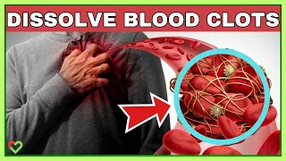 Top 7 Foods That Dissolve Your Blood Clots Naturally 🔥