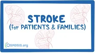 Stroke (for patients & families)