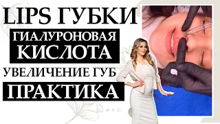 Lips Губки. Гиалуроновая кислота для увеличение губ. Практика.